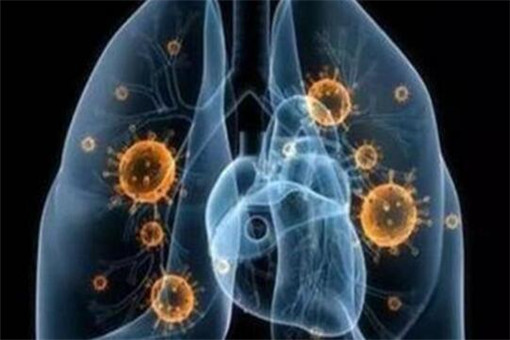 风心病突发大咯血，症状解析、原因探究与应对之策